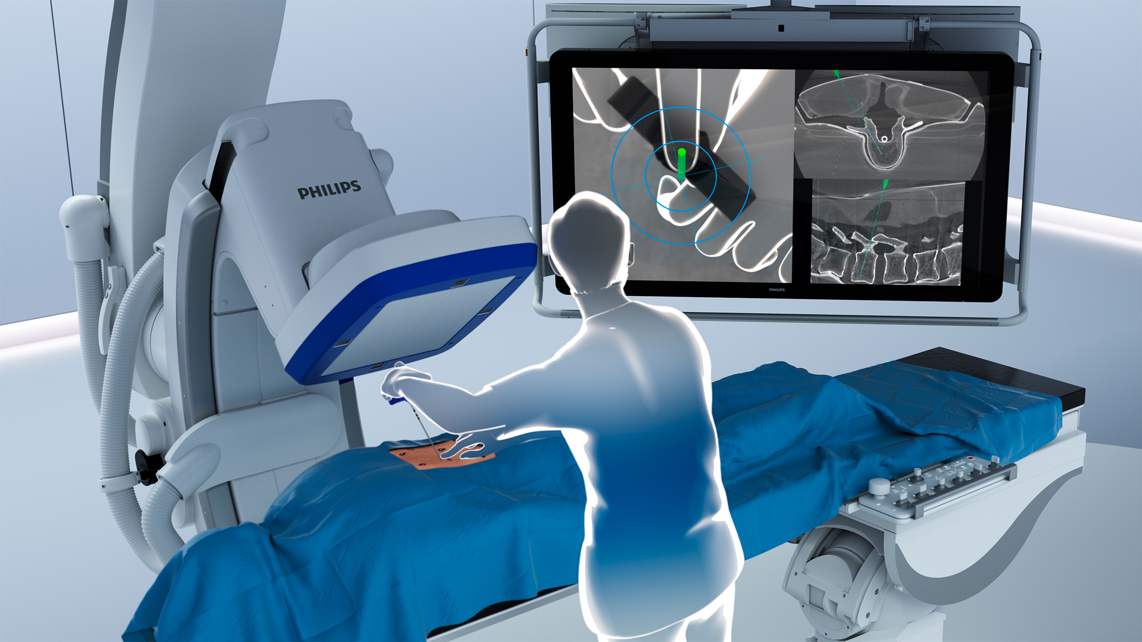 The FDA has approved an AR solution to simplify navigation during spine ...